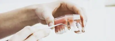 implant-dentaire-rembousement