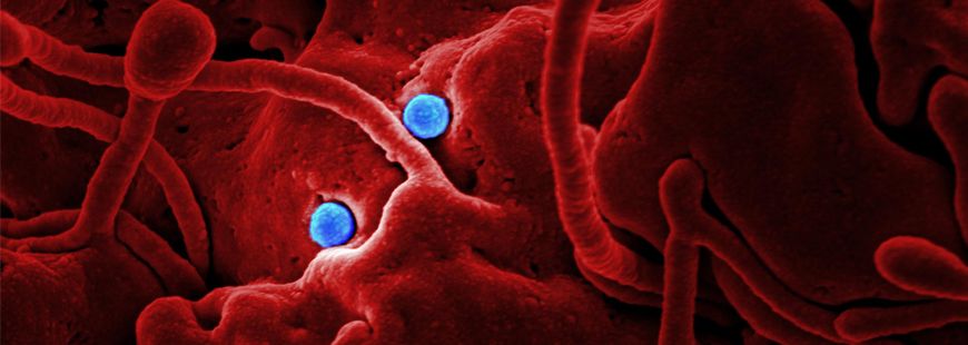 Le coronavirus COVID-19 a fortement ralenti l'économie mondiale coronavirus